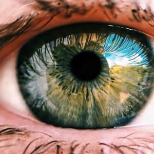 close up of the acute angle closure glaucoma during eye examination.